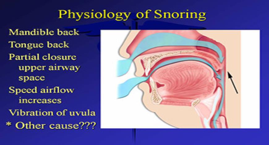 Download Free Medical Sleep Disordered Breathing and Dentistry ...