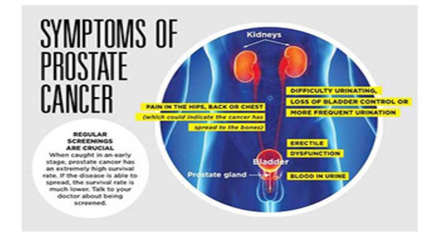 Download Free Medical Prostate Cancer PowerPoint Presentation