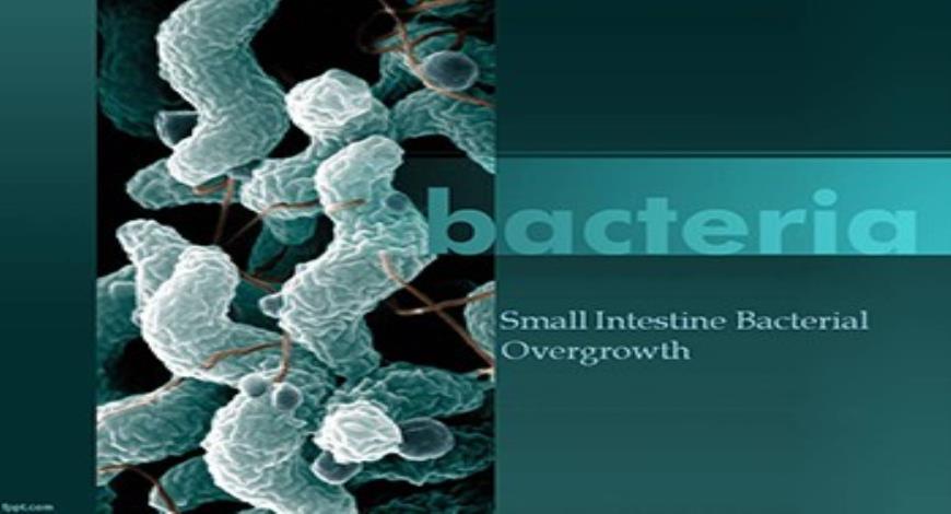 Download Free Medical Small Intestine Bacterial Overgrowth SIBO ...