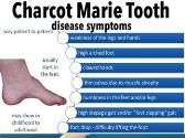 Download Medical Notes on Charcot Marie Tooth