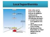 Local Hyperthermia