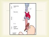 Esophagus: Anatomy Physiology Corrosive stricture and Perforation of Esophagus