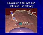 Intravenous Reolysin in Bone and Soft Tissue Sarcoma Metastatic to Lung PowerPoint Presentation