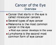 Cancers of the Eye PowerPoint Presentation