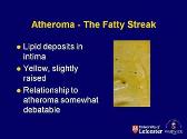 Atheroma