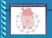 Making ECGs Easy