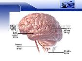 Hemorrhagic stroke