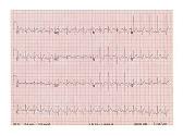 Paediatric Cardiology