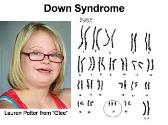 Karyotypes and Chromosomal Disorders