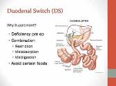 Nutrition and Weight Loss Surgery