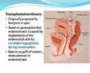 Endometriosis PowerPoint Presentation