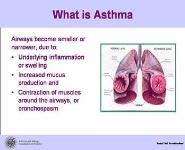 Exercise-Induced Asthma PowerPoint Presentation