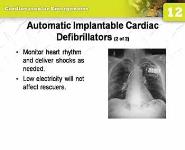Cardiovascular Emergencies PowerPoint Presentation