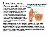 Work related Musculoskeletal Disorders