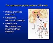 Fibromyalgia and the Social Construction of Disease PowerPoint Presentation