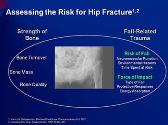 Recovering From Hip Fracture