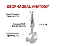 Esophagus and Disorders PowerPoint Presentation