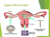 Contraceptive Methods