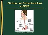 GERD Case Study