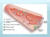 Chronic Kidney Disease