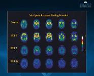 Medication Assisted Treatment PowerPoint Presentation