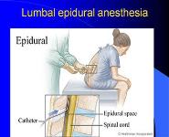 Anesthesiology Intensive Care Medicine And Resuscitation PowerPoint Presentation