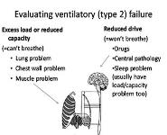 Respiratory Failure Diagnosis and Management PowerPoint Presentation