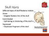 Acute Traumatic Brain Injury Nursing Self-Paced Case Study