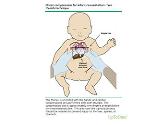 Neonatal resuscitation-NNR