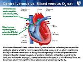 Management of Sepsis