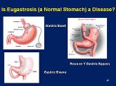 Obesity Dyslipidemia And The Metabolic Syndrome