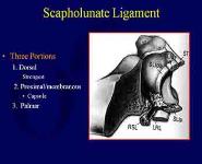 Carpal Fractures and Dislocations PowerPoint Presentation