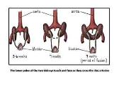 Kidney and Ureters-Agenesis Horseshoe Kidneys Congenital Cysts Megaureter Ectopic Ureter Ureterocele