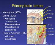 About Brain Tumors PowerPoint Presentation