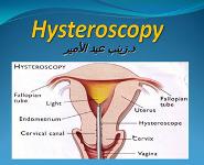 About Hysteroscopy PowerPoint Presentation