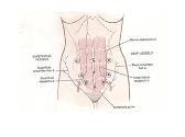 Endoscopy In Gynecology