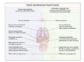 Cystic Fibrosis