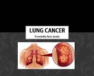 Lung Cancer PowerPoint Presentation